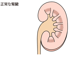 正常な腎臓
