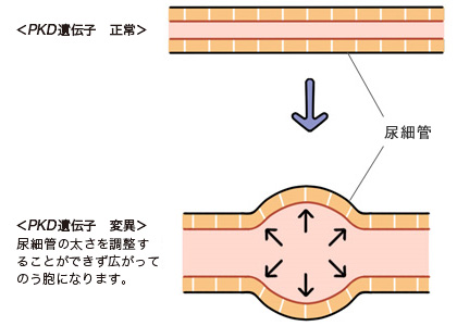 嚢胞はどのようにできるの?