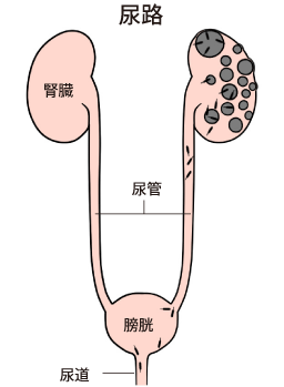 嚢胞感染