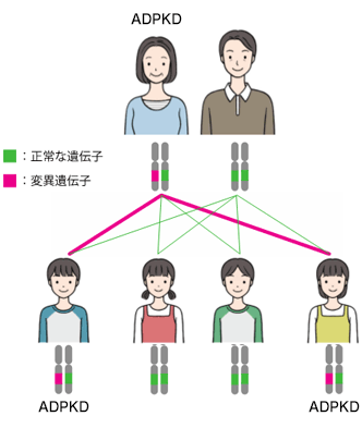 常染色体優性遺伝
